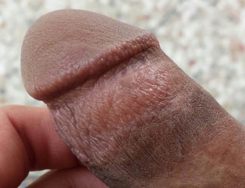 best of Masturbation Dry skin