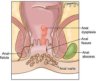 Mustard reccomend Itch near anus Itchy Rectum and Anus Causes and Treatment