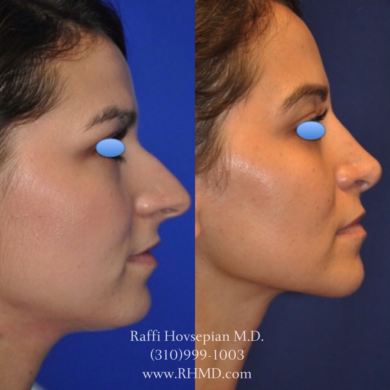 Snout reccomend Dr facial make over