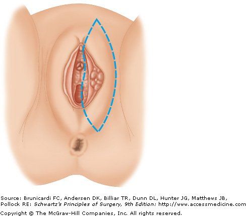 Tomahawk reccomend Clitoris abscess during pregnancy