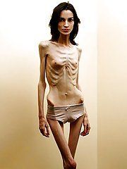 best of Naked girls Slim anorexic