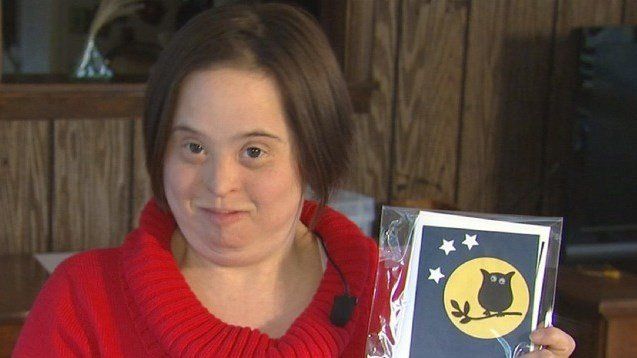 Down syndrome adult females