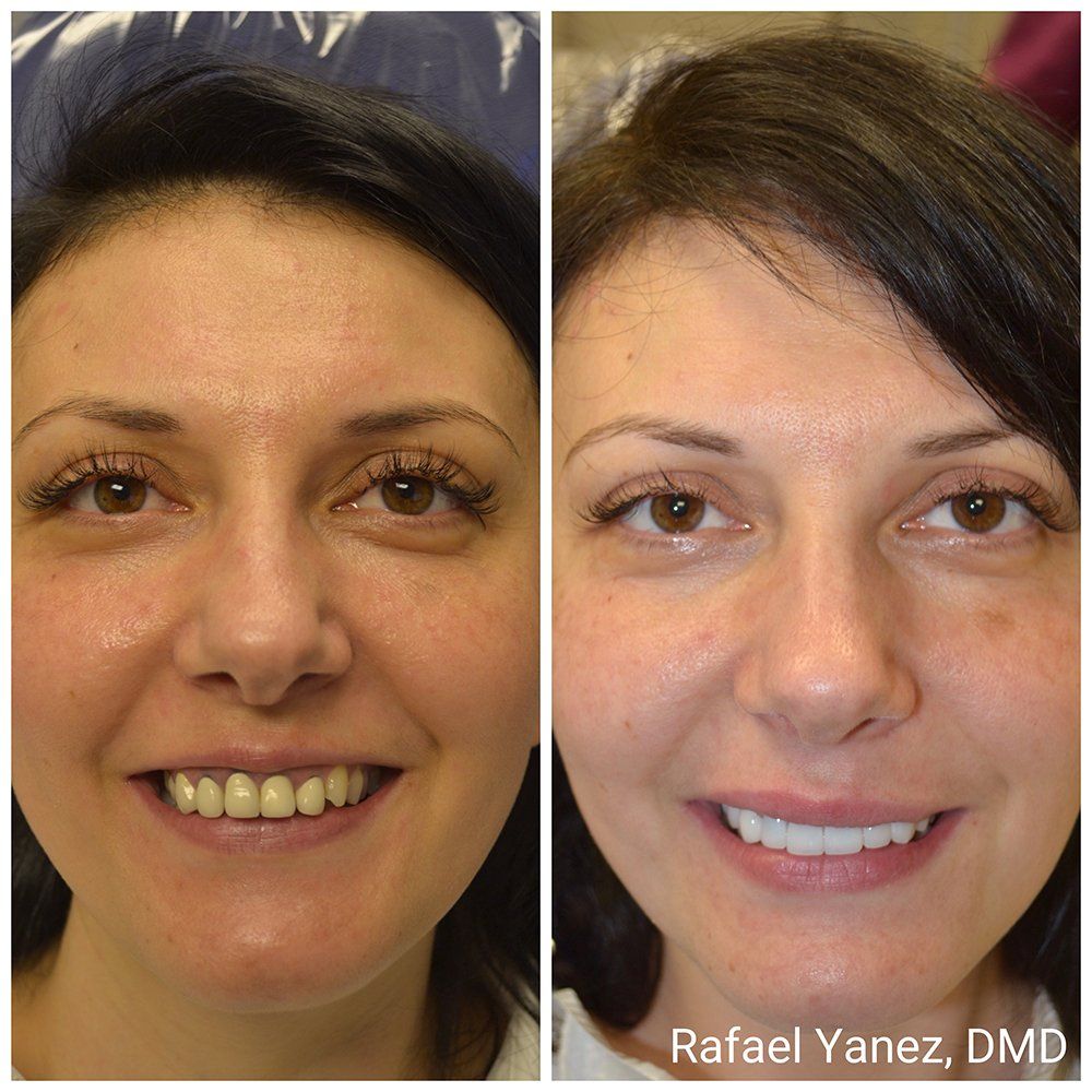 Dr facial make over