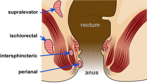 Air A. reccomend Hair removal rectum anus