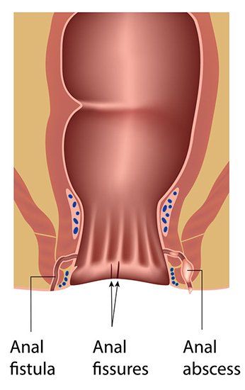 best of Rectum Itchy and anus Causes Itch near Anus Treatment and