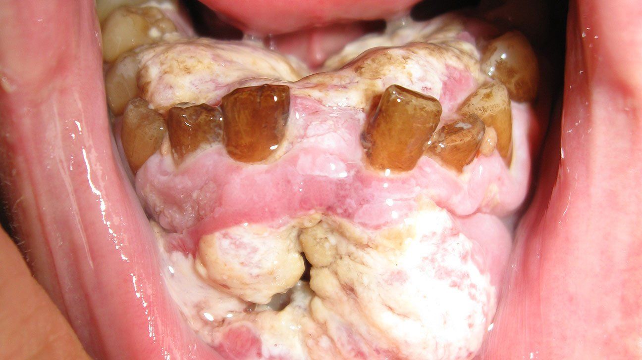 best of Mouth Pain of eating when roof in