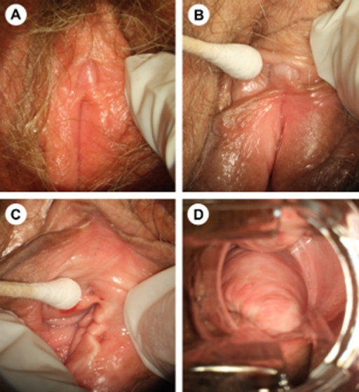 Pics of the clitoris