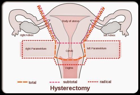 Batter reccomend Sexual response after hysterectomy
